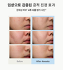 Set [1+2mini+Quà][OliveYoung] Kem Dưỡng Dr. Althea 345 Relief Cream 50ml Tặng Kèm 2 tuýp mini 10ml + Tube Wringer