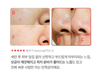 [OliveYoung] Sữa Rửa Mặt Làm Sạch Sâu & Hỗ Trợ Chăm Sóc Lỗ Chân Lông MEDI-PEEL Red Lacto Collagen Clear Foam Cleanser 2.0 Phiên Bản Dung Tích Lớn 300ml – Tặng Kèm Mút Rửa Mặt (Deep Cleansing Sponge)